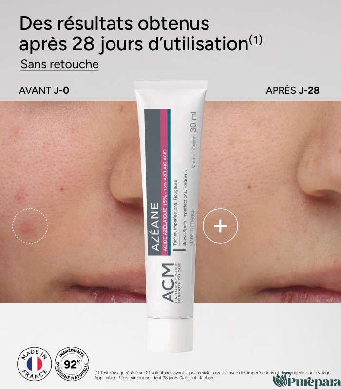 ACM Azéane crème - Acide azélaïque 15% 30 ML – Image 2